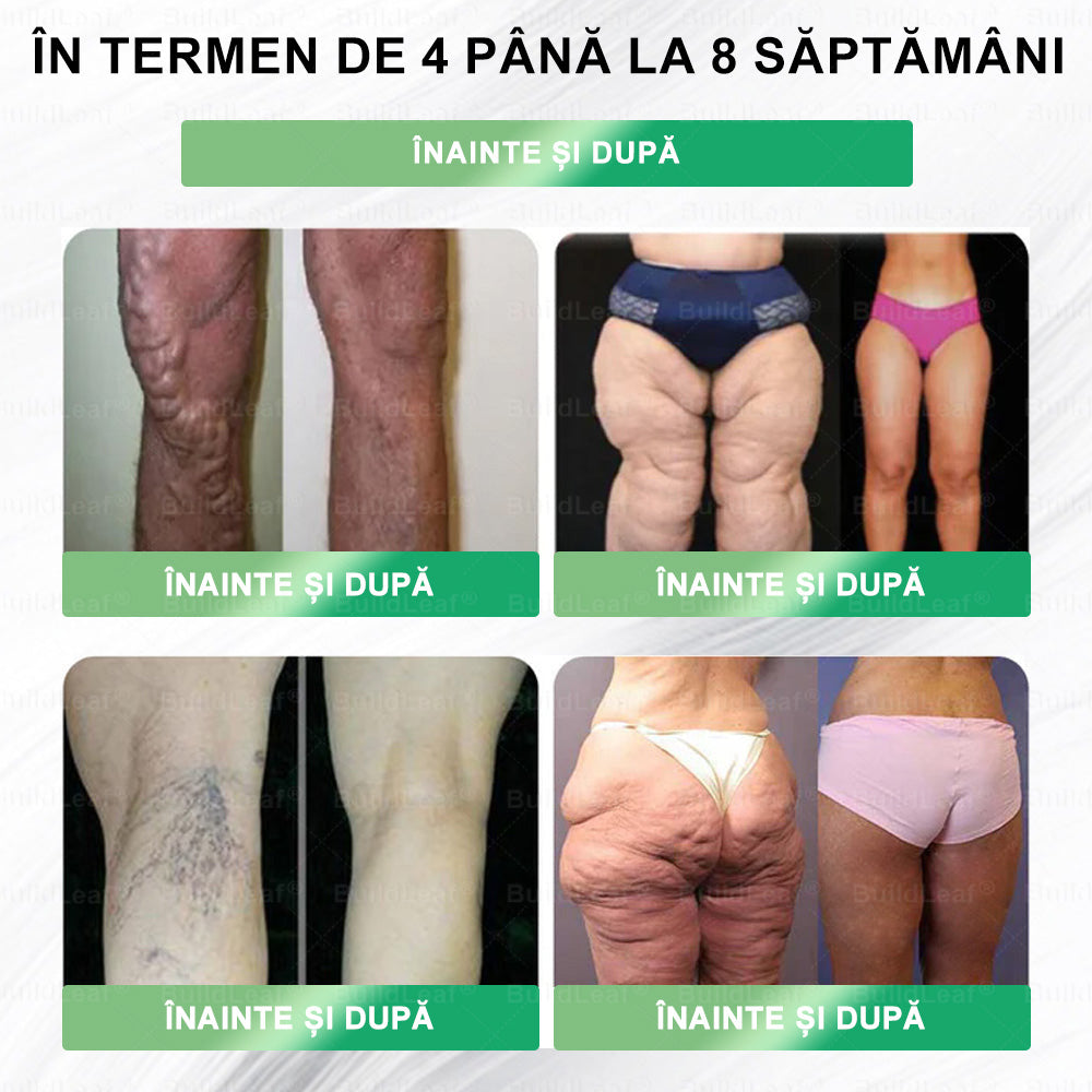🎁𝑩𝒖𝒊𝒍𝒅𝑳𝒆𝒂𝒇® GLP-1 8-în-1 Fit & Vital Soluție orală – ⏰ O dată pe zi, schimbări vizibile în 7 zile / Pentru obezitate, sănătatea inimii și a sistemului cardiovascular, diabet, apnee de somn, sănătatea intestinelor, probleme articulare și multe altele🎁