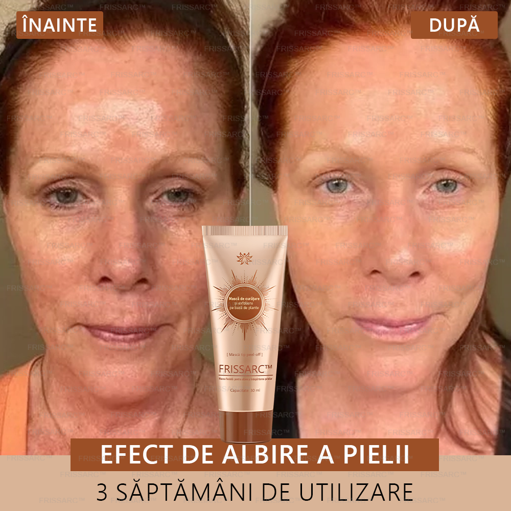 🔥FRISSARC™ masca facială pentru albire și îndepărtarea petelor –🍀Ingredientele naturale ajută la eliminarea eficientă și de durată a petelor pigmentare, petelor de vârstă, pistruilor și petelor solare.