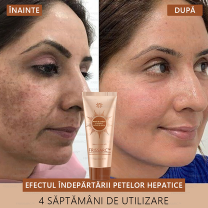 🎁 Felicitări! Te numeri printre primele 200 de comenzi! Profită acum de o reducere suplimentară de 50%! Acționează acum pentru a avea grijă de sănătatea pielii tale. Dacă ratezi această ocazie, la anul s-ar putea să nu mai existe! 🎁 Grăbește-te!